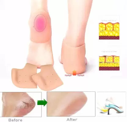 Silicone Gel Heel Pad Socks